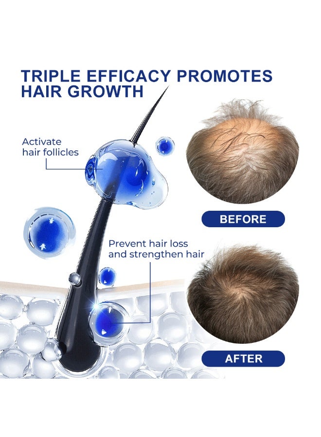 Sumifun Hair Growth and Anti-Hair Loss Essence - Professional Hair Growth Care, Strengthens Hair Roots, Improves Thinning Hair 30ml - Image 5